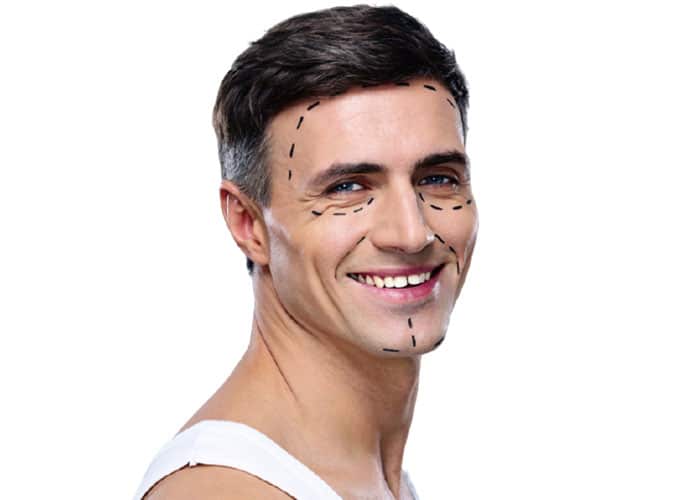 Male-Chin-Augmentation