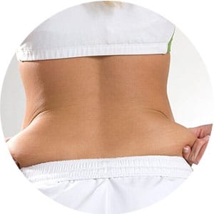 Stubborn-Fat