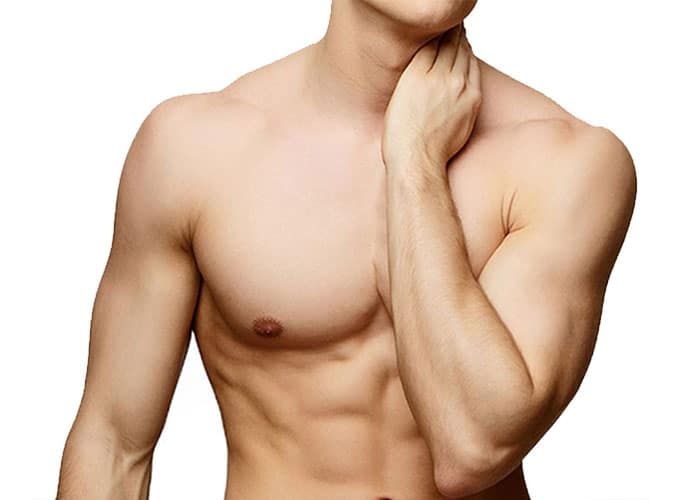 Gynecomastia